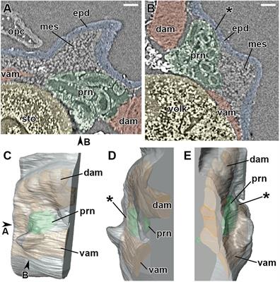 Development of the Pectoral Lobed Fin in the Australian Lungfish Neoceratodus forsteri